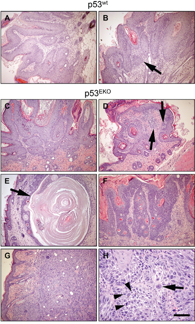 Histological aspect of chemically induced skin tumors.