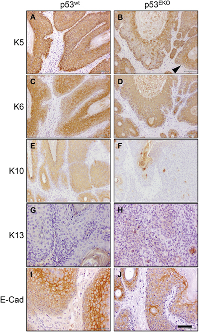 Altered keratin and E-cadherin expression in p53EKO tumors.