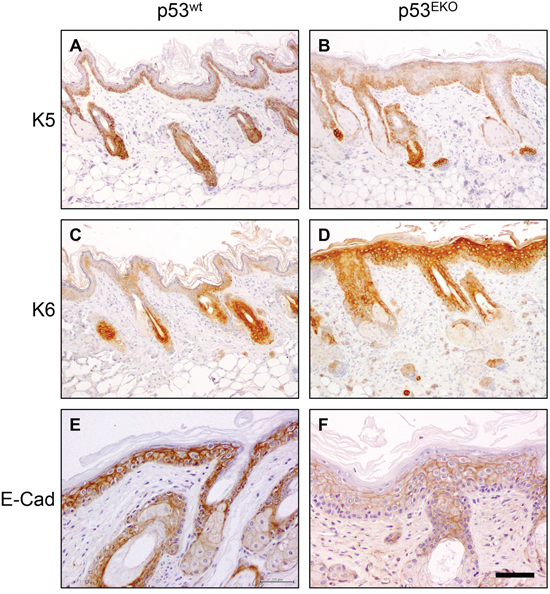Altered keratin and E-cadherin expression in non-tumoral p53EKO skin.