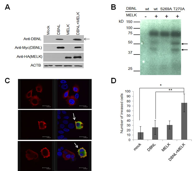 MELK phosphorylated Ser269 on DBNL and induced the cellular invasiveness.