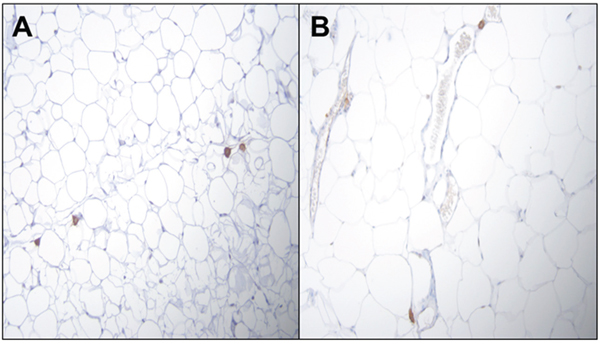 Representative figures of H&#x0026;E staining of PIRC rat adipose tissue (200x magnification) following: