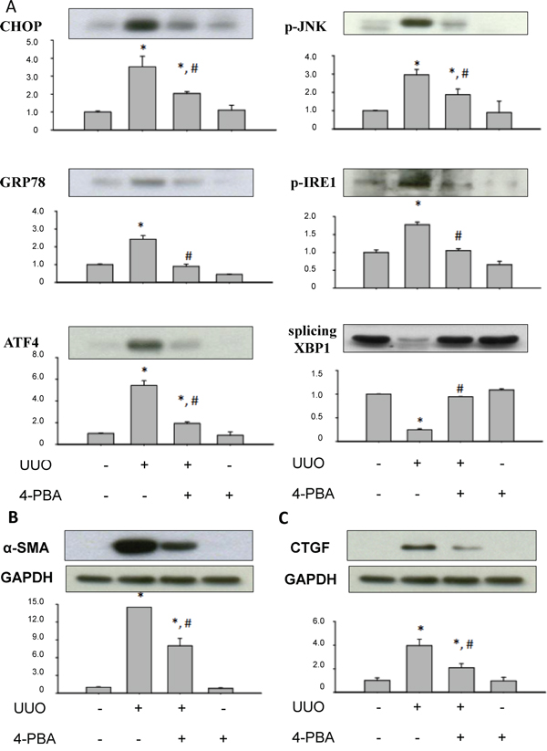 4-PBA attenuated overwhelming ER stress response and profibrotic markers in kidneys of UUO rats.