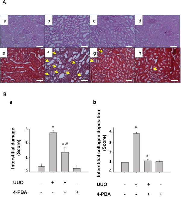 4-PBA ameliorated interstitial damage and collagen deposition in UUO rat kidneys.