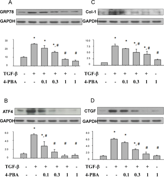 4-PBA attenuated ER stress-related molecules and fibrosis markers induced by TGF-&#x03B2; in renal tubular NRK52E cells.