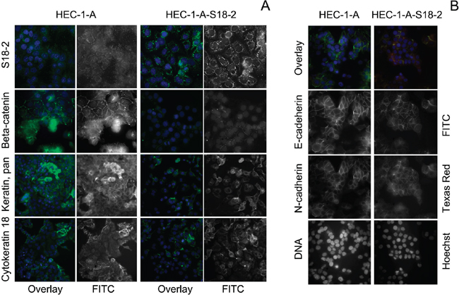 Expression pattern of S18-2, beta-catenin, pan-keratin, cytokeratin 18, E- and N-cadherins in HEC-1-A-S18-2 cells compared with HEC-1-A.