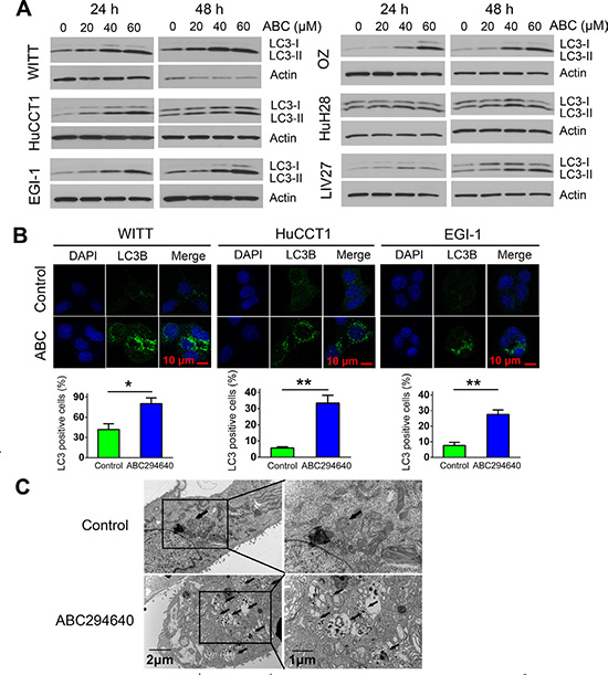 ABC294640 induces autophagy in cholangiocarcinoma cells.