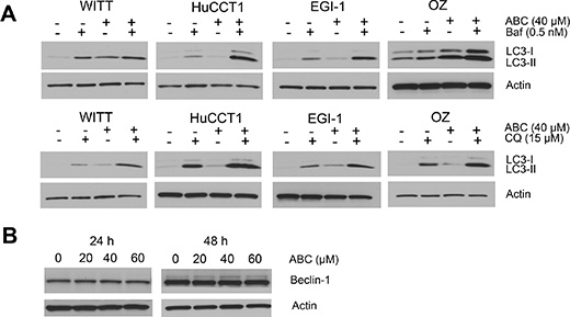 ABC294640 activates autophagic flux in cholangiocarcinoma cells.