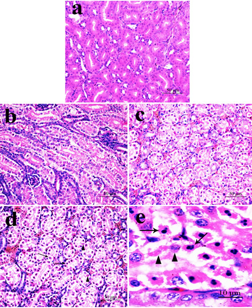 Histopathological changes in the kidney at 42 days of age (HE).