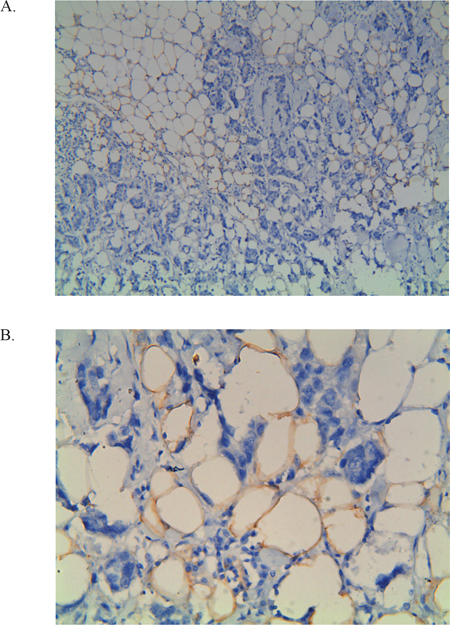 Example of immunohistochemical staining with FABP4.