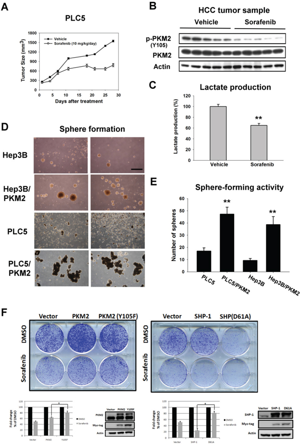 In vivo effect of PKM2 on sorafenib-treated HCC xenograft.