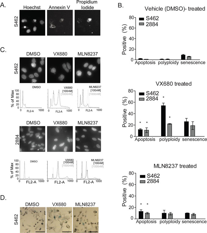 AKI treatment results in growth arrest, apoptosis, polyploidy and cellular senescence in MPNST cell lines.