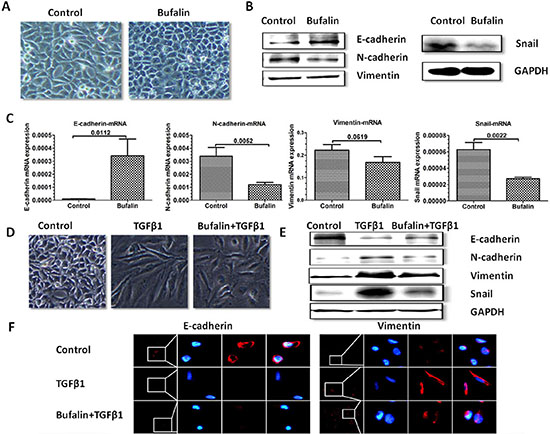 Bufalin inhibits TGF-&#x03B2;1-induced EMT in SMMC7721 cells.