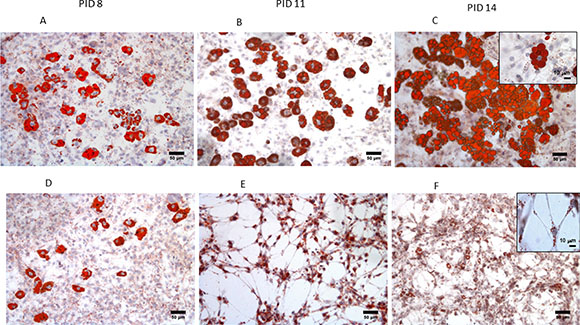 Morphological changes of 3T3-L1 adipocytes during co-culture with MiaPaCa2 cells.