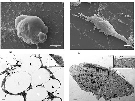 Representative electron microscopy images of 3T3-L1 adipocytes alone or in co-culture with MiaPaCa2 cells.