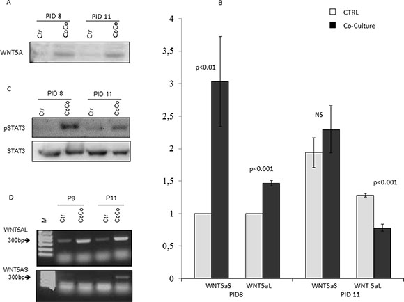 Activation of WNT5a pathway in MiaPaCa2 cells and adipocytes in co-culture.