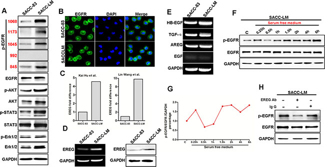Autocrine EREG secretion contributes to the auto-activation of EGFR in highly metastatic SACC.