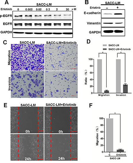 Targeting EGFR inhibits the migration and invasion capabilities of SACC-LM cells.