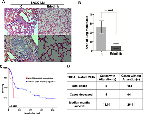 Targeting EGFR inhibits the lung metastasis of SACC in vivo.