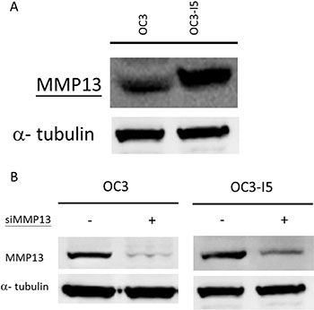 Expression of MMP-13 in oral cancer OC3 and metastasis-enhanced OC3-I5 and the knockdown efficiency of siMMP-13.