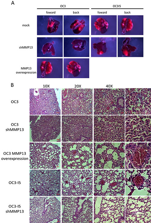 Stable knockdown of MMP-13 in human oral cancer cells decreases metastasis in vivo.