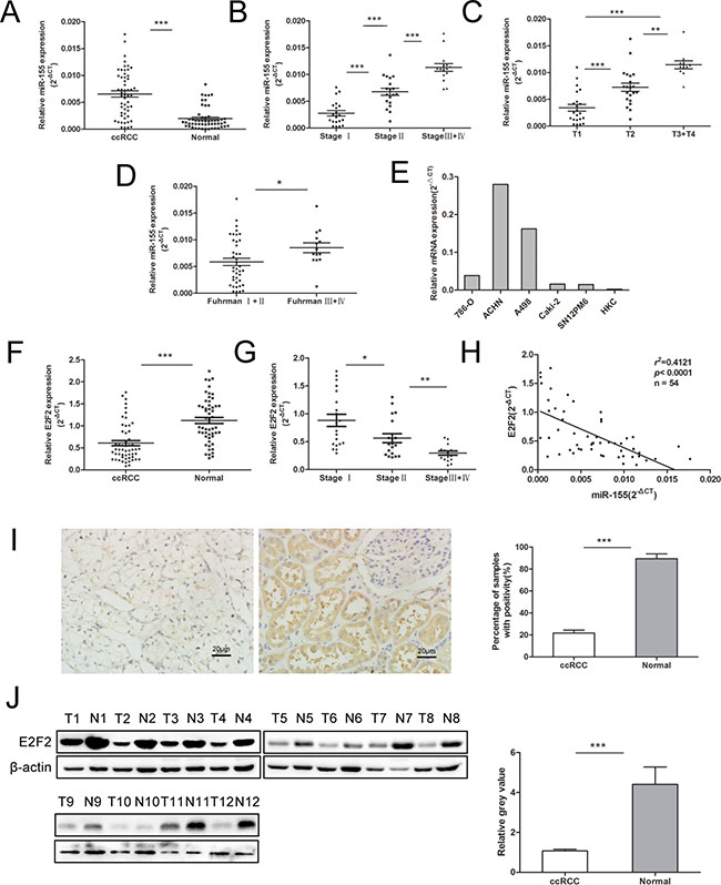 Expression of miR-155 in clinical samples and various cell lines and its relationship with E2F2 expression.