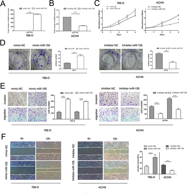 Influence of miR-155 on tumor cell proliferation, migration, and invasion.