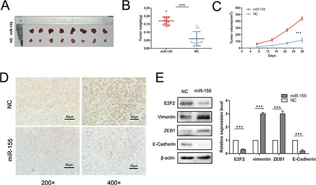 Overexpression miR-155 promoted tumor growth in vivo.