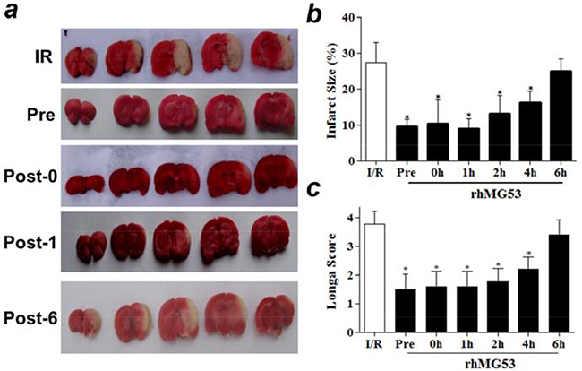 rhMG53 protects against I/R injury to rat brains.