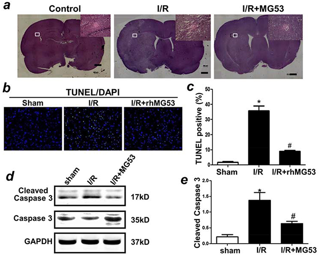 rhMG53 improves pathology and inhibits apoptosis of neural cells associated with I/R injury.