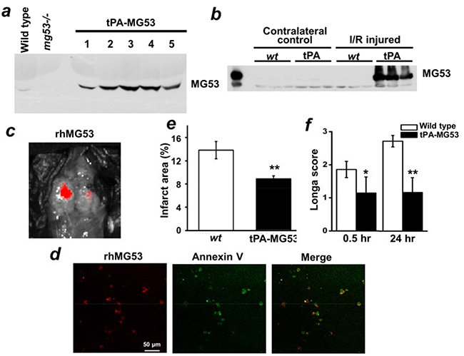 MG53 can cross the blood-brain-barrier to target to injured brain tissue.