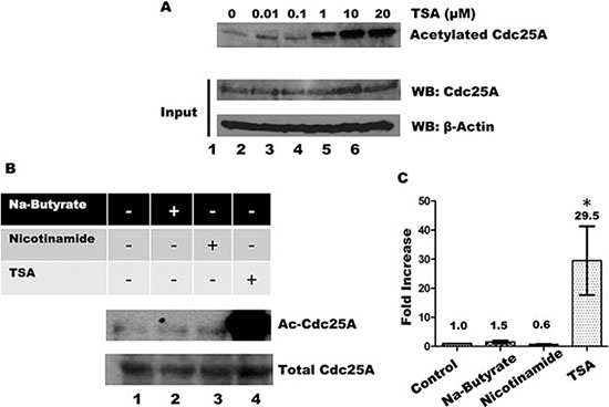 Influence of HDACs and Sirtuins in Cdc25A acetylation levels.
