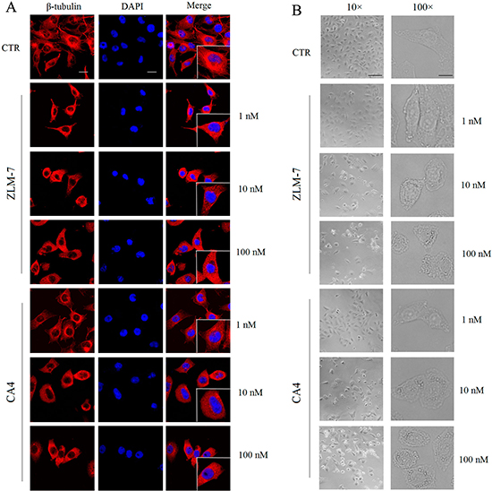 Effect of ZLM-7 on cytoskeleton and morphology in HUVECs.