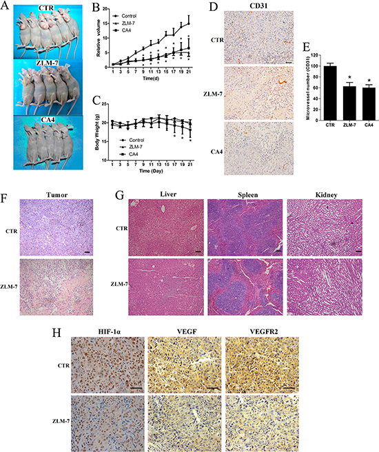 ZLM-7 inhibited tumor growth and neoangiogenesis in MCF-7 breast cancer xenografts.