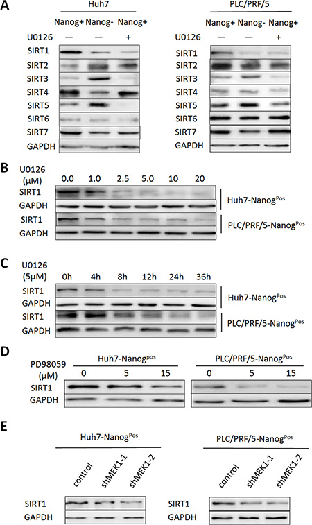 MEK1 mainly promotes SIRT1 expression in HCC population.