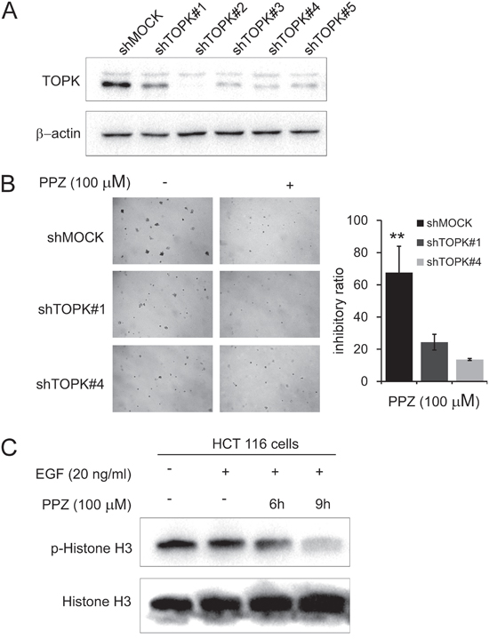 Knocking down TOPK attenuates the inhibitory effect of colon cancer cell growth by pantoprazole.