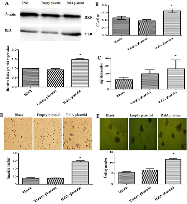 High RalA GTPase activity increases K562 cell malignant progression.