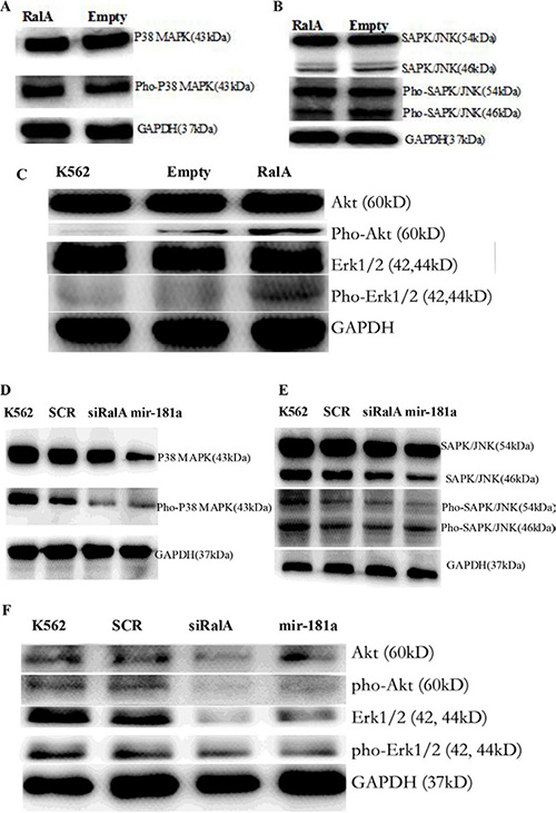 Western blot validation of the several key phosphorylation signal proteins through overexpression of RalA or RalA siRNA/miR-181a mimic.