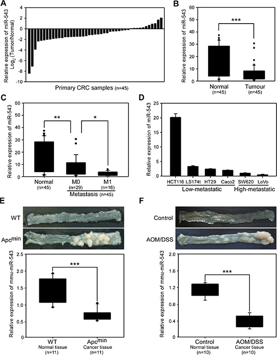 miR-543 expression is downregulated in clinical colorectal cancer (CRC) samples, CRC cell lines and mouse CRC tissues.