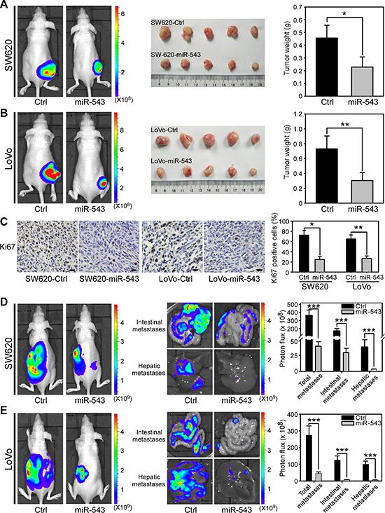 miR-543 overexpression inhibits the tumor growth and metastasis of CRC cells in vivo.