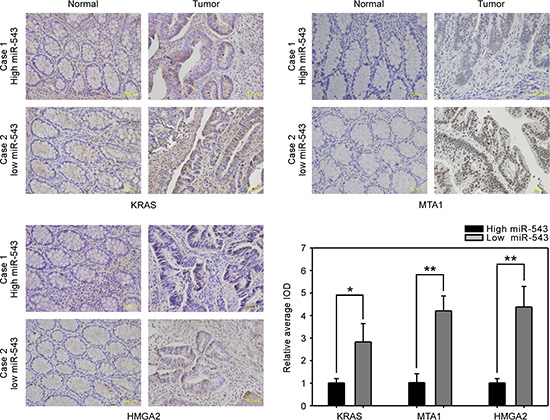 Clinical correlation analysis of the level of miR-543 and its targets in CRC tissues.