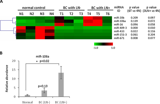 Identification of circulating miRNAs as novel biomarkers for detecting metastatic breast cancer.