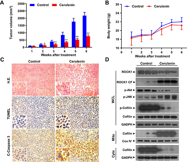 Cerulenin inhibits tumor growth in a jurkat xenograft mouse model.