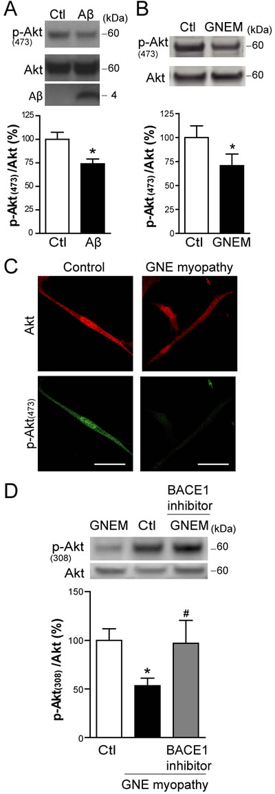 A&#x3b2; impairs basal Akt activation in skeletal muscle cells.