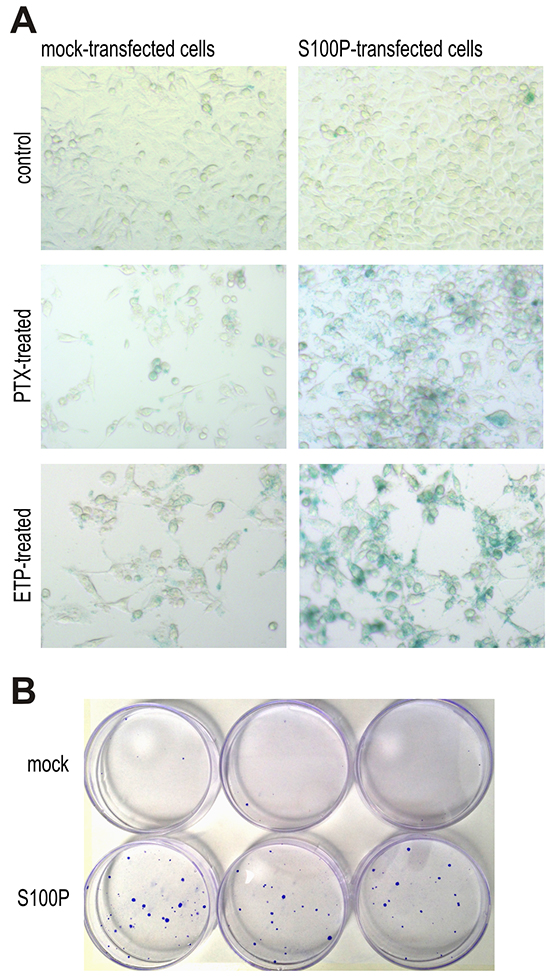 S100P contributes to therapy-induced senescence and survival.