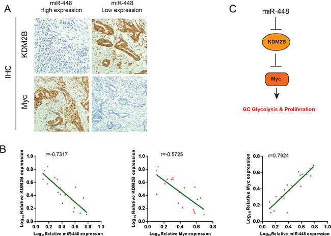Clinical relevance of miR-448, KDM2B and Myc Expression in patients with GC.