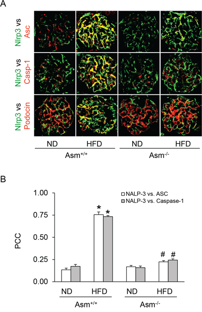 Attenuation of HFD-induced inflammasome formation in glomeruli of Asm+/+ and Asm-/- mice fed a normal diet or high fat diet.