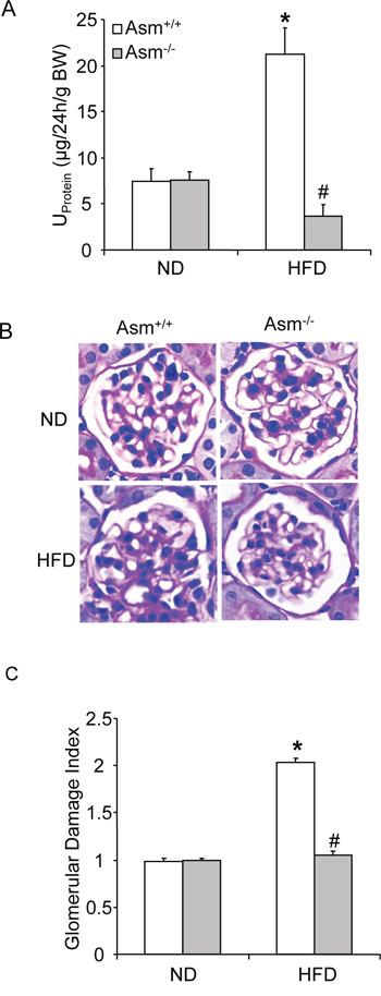 Effects of the normal diet and high fat Diet on glomerular injury in Asm+/+ and Asm-/- mice.