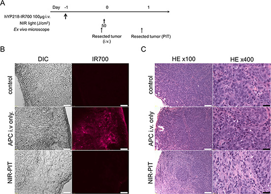 In vivo histological fluorescence distribution and histological NIR-PIT effect.