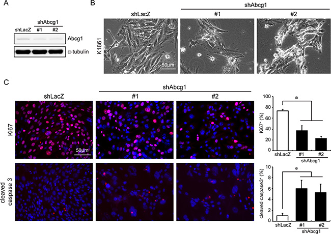 Abcg1 knockdown reduces NPcis glioma cell growth in vitro.