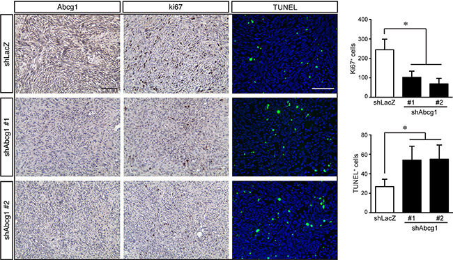 Abcg1 knockdown increases glioblastoma apoptosis in vivo.